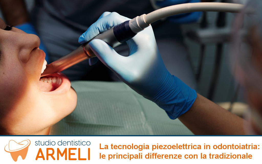 Tecnologia Piezoelettrica Odontoiatria